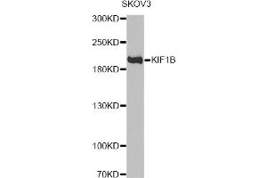 Western blot analysis of extracts of SKOV3 cells, using KIF1B antibody. (KIF1B Antikörper)