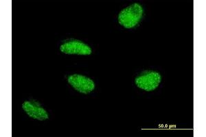 Immunofluorescence of monoclonal antibody to MSH5 on HeLa cell. (MSH5 Antikörper  (AA 736-835))