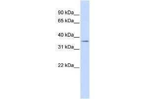 WB Suggested Anti-TRIM69 Antibody Titration:  0.