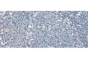 Immunohistochemistry of paraffin-embedded Human tonsil tissue using LASP1 Polyclonal Antibody at dilution of 1:35(x200) (LASP1 Antikörper)
