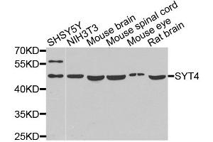 Western blot analysis of extracts of various cell lines, using SYT4 antibody (ABIN5975174) at 1/1000 dilution. (SYT4 Antikörper)