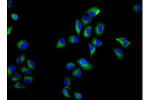 Immunofluorescence staining of Hela cells with ABIN7161019 at 1:66, counter-stained with DAPI. (NOXO1 Antikörper  (AA 304-376))