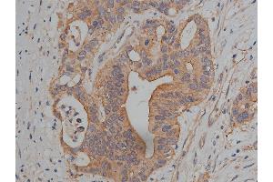 Immunohistochemistry (IHC) image for anti-Junction Plakoglobin (JUP) (C-Term) antibody (ABIN6260497)