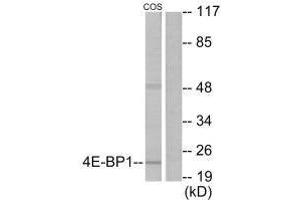 Western blot analysis of extracts from COS7 cells, treated with EGF (200 ng/mL, 30 mins), using 4E-BP1 (Ab-69) antibody. (eIF4EBP1 Antikörper  (Thr70))