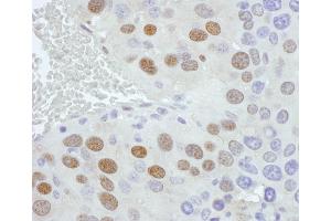 Immunohistochemistry (IHC) image for anti-Phosphate Cytidylyltransferase 1, Choline, alpha (PCYT1A) (AA 1-50) antibody (ABIN7454584) (PCYT1A Antikörper  (AA 1-50))