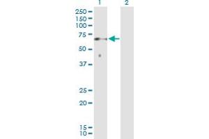 Western Blot analysis of SOCS6 expression in transfected 293T cell line by SOCS6 MaxPab polyclonal antibody. (SOCS6 Antikörper  (AA 1-535))