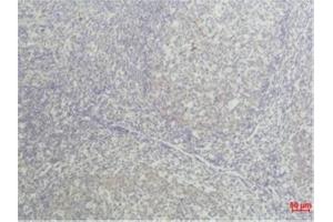 Immunohistochemical analysis of paraffin-embedded Human Tonsil Tissue using TNF aMouse mAb diluted at 1:50. (TNF alpha Antikörper)