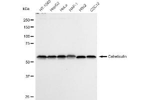 Western blotting analysis using Calreticulin antibody (ABIN7797853).