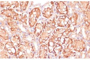 Immunohistochemistry of paraffin-embedded Mouse kidney using MAP2K3 Polyclonal Antibody at dilution of 1:100 (40x lens). (MAP2K3 Antikörper)