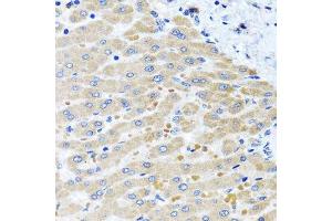 Immunohistochemistry (Paraffin-embedded Sections) (IHC (p)) image for anti-Aspartyl-tRNA Synthetase 2, Mitochondrial (DARS2) (AA 406-645) antibody (ABIN6139409)