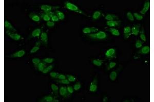 Immunofluorescence staining of Hela cells with ABIN7171577 at 1:100, counter-stained with DAPI. (TAF15 Antikörper  (AA 93-206))