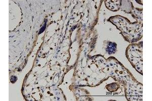 Image no. 4 for anti-Ureidopropionase, beta (UPB1) (AA 285-385) antibody (ABIN599563) (UPB1 Antikörper  (AA 285-385))