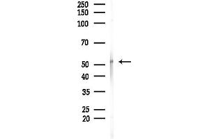 anti-Phospholipid Transfer Protein (PLTP) (Internal Region) antibody