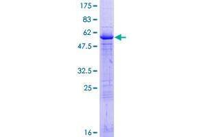 CENPP Protein (AA 1-288) (GST tag)