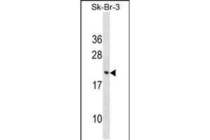 Western blot analysis in SK-BR-3 cell line lysates (35ug/lane). (CNIH3 Antikörper  (N-Term))