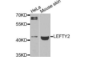 Western blot analysis of extracts of various cell lines, using LEFTY2 antibody (ABIN6003578) at 1/1000 dilution. (LEFTY2 Antikörper)