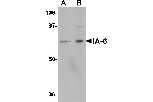 Western blot analysis of IA-6 in rat thymus tissue lysate with IA-6 antibody at (A) 1 and (B) 2 µg/mL. (INSM2 Antikörper  (C-Term))