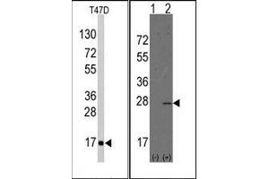 Image no. 1 for anti-Anterior Gradient Homolog 2 (Xenopus Laevis) (AGR2) (N-Term) antibody (ABIN358783) (AGR2 Antikörper  (N-Term))