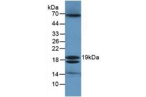 Detection of ECO in Ecoli Cells using Polyclonal Antibody to Ecotin (ECO) (Ecotin (AA 21-162) Antikörper)