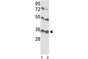 Western blot analysis of VDAC1 antibody and 1) HL-60 and 2) Y79 lysate.