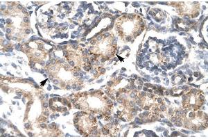 Human kidney; RGS20 antibody - middle region in Human kidney cells using Immunohistochemistry (RGS20 Antikörper  (all Isoforms, Middle Region))