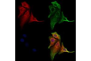 ABIN6260408 and ABIN6273204 staining Hela cells by IF/ICC.