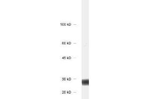 dilution: 1 : 1000, sample: rat brain homogenate (CALB1 Antikörper)