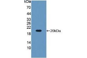 Western blot analysis of recombinant Mouse IGFBP3.