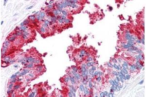 Human Prostate: Formalin-Fixed, Paraffin-Embedded (FFPE) (ADAM20 Antikörper  (Internal Region))