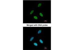 ICC/IF Image Immunofluorescence analysis of paraformaldehyde-fixed HeLa, using TAP, antibody at 1:200 dilution. (NXF1 Antikörper  (C-Term))