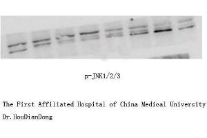 Western Blot (WB) analysis: Please contact us for more details.
