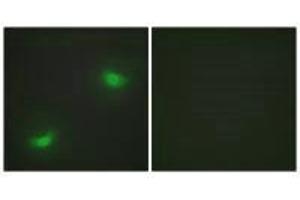 Immunofluorescence analysis of HepG2 cells, using DUSP16 antibody. (DUSP16 Antikörper)