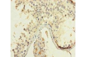 Immunohistochemistry of paraffin-embedded human testis tissue using ABIN7155217 at dilution of 1:100 (HMGB4 Antikörper  (AA 1-186))
