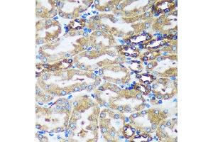 Immunohistochemistry of paraffin-embedded Mouse kidney using FBXO21 Rabbit pAb (ABIN7267085) at dilution of 1:100 (40x lens). (FBXO21 Antikörper  (AA 440-621))