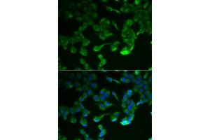 Immunofluorescence analysis of HeLa cells using C1R antibody (ABIN5973769). (C1R Antikörper)