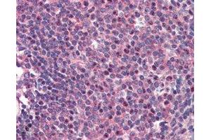ABIN2561564 (2µg/ml) staining of paraffin embedded Human Spleen. (CARD11 Antikörper  (C-Term))