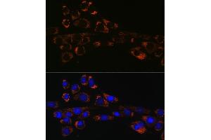 Immunofluorescence analysis of NIH-3T3 cells using HSP47/SERPINH1 Rabbit mAb (ABIN7270238) at dilution of 1:100 (40x lens). (SERPINH1 Antikörper)