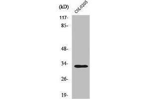 Western Blot analysis of COLO205 cells using UBCE7IP4 Polyclonal Antibody (RNF144A Antikörper  (Internal Region))