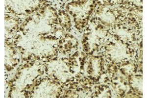 ABIN6273081 at 1/100 staining Human lung tissue by IHC-P. (TLE3 Antikörper  (Internal Region))