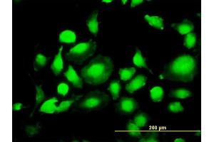 Immunofluorescence of monoclonal antibody to MAPK1 on HeLa cell. (ERK2 Antikörper  (AA 261-360))