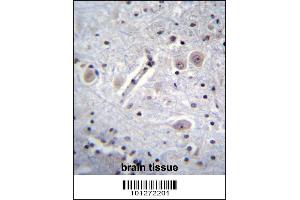 MARK Antibody immunohistochemistry analysis in formalin fixed and paraffin embedded human brain tissue followed by peroxidase conjugation of the secondary antibody and DAB staining. (MARK1 Antikörper  (C-Term))