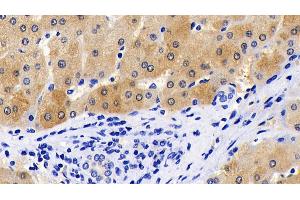 Immunohistochemistry (IHC) image for anti-Caspase 8 (CASP8) (AA 385-479) antibody (ABIN7437074)