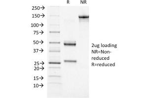 SDS-PAGE Analysis Purified BRCA1 Mouse Monoclonal Antibody (BRCA1/1472). (BRCA1 Antikörper  (AA 445-620))