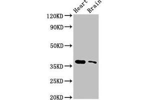Western Blot Positive WB detected in: Mouse heart tissue, Mouse brain tissue All lanes: SRR antibody at 3 μg/mL Secondary Goat polyclonal to rabbit IgG at 1/50000 dilution Predicted band size: 37 kDa Observed band size: 37 kDa (SRR Antikörper  (AA 1-340))