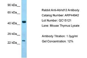 WB Suggested Anti-Abhd12 Antibody   Titration: 1. (ABHD12 Antikörper  (C-Term))