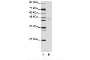 Image no. 1 for anti-Tripartite Motif Containing 14 (TRIM14) (AA 116-165) antibody (ABIN203143) (TRIM14 Antikörper  (AA 116-165))