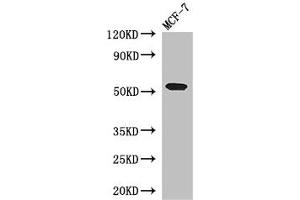 Western Blot Positive WB detected in: MCF-7 whole cell lysate All lanes: PSEN1 antibody at 3 μg/mL Secondary Goat polyclonal to rabbit IgG at 1/50000 dilution Predicted band size: 53, 43, 22, 47, 49 kDa Observed band size: 53 kDa (Presenilin 1 Antikörper  (AA 4-218))