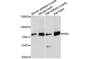 Western blot analysis of extracts of various cell lines, using SKIL antibody (ABIN6292273) at 1:3000 dilution. (SKIL Antikörper)