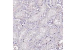 Immunohistochemical staining of human kidney with C10orf35 polyclonal antibody  shows distinct membranous positivity in subsets of glomerular cells at 1:500-1:1000 dilution. (C10ORF35 Antikörper)