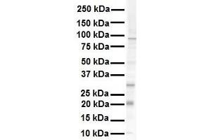 WB Suggested Anti-KRAS antibody Titration: 1 ug/mL Sample Type: Human RPMI-8226